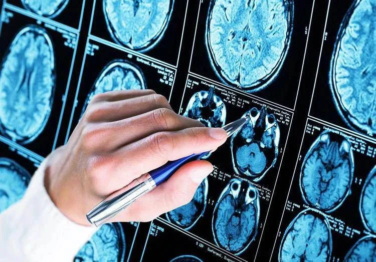 Alzheimer: €300 mil para 6 jovens cientistas impulsionarem diagnóstico precoce e prevenção
