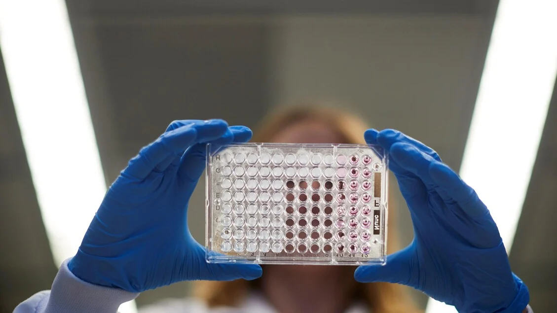 AIFA aprova enfortumab vedotin + pembrolizumab como alternativa à quimioterapia no carcinoma urotelial