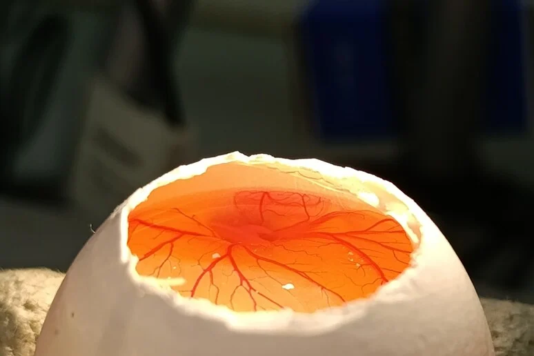 Avatar 3D do tumor infantil: Nova plataforma para entender o osteosarcoma pediátrico