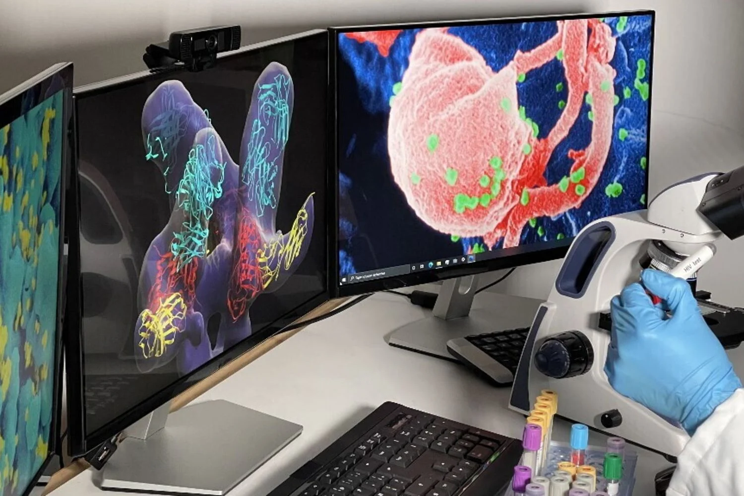 Vacina experimental contra HIV induz anticorpos já após uma única dose em primatas