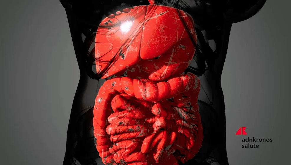 Doença de Crohn: apenas 1 em cada 3 pacientes tem acesso a apoio nutricional especializado