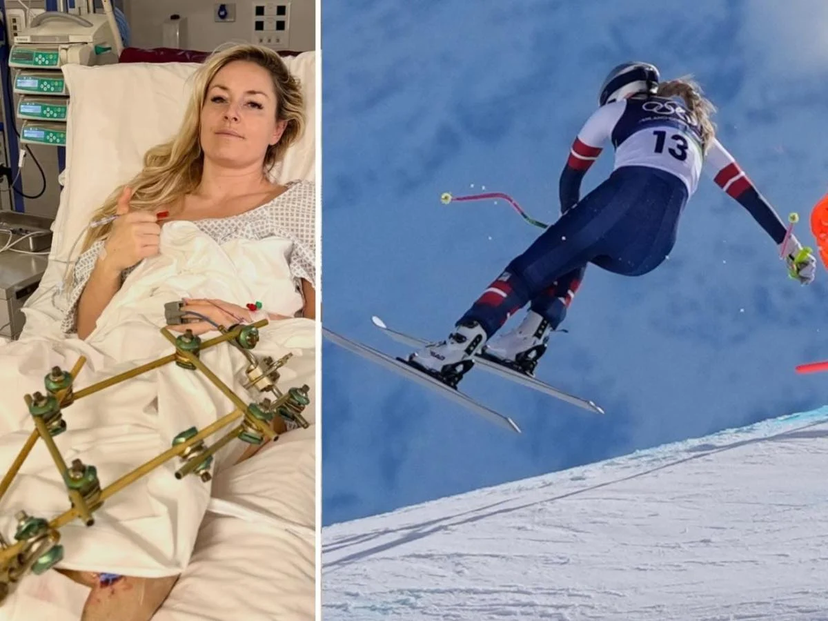 Lindsey Vonn passa por terceiro procedimento em Treviso e diz 'estou fazendo progressos'