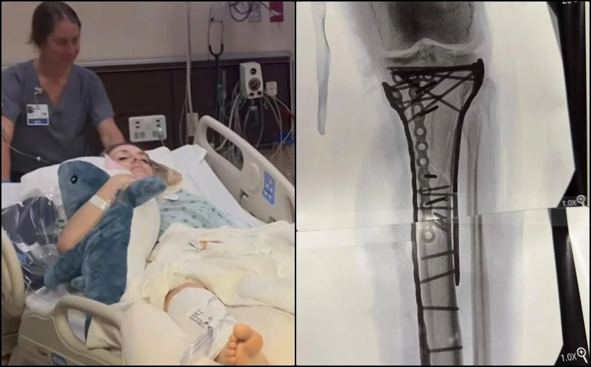 Lindsey Vonn atualiza sobre cirurgia após queda em Milano Cortina 2026: "Dor difícil de gerir"