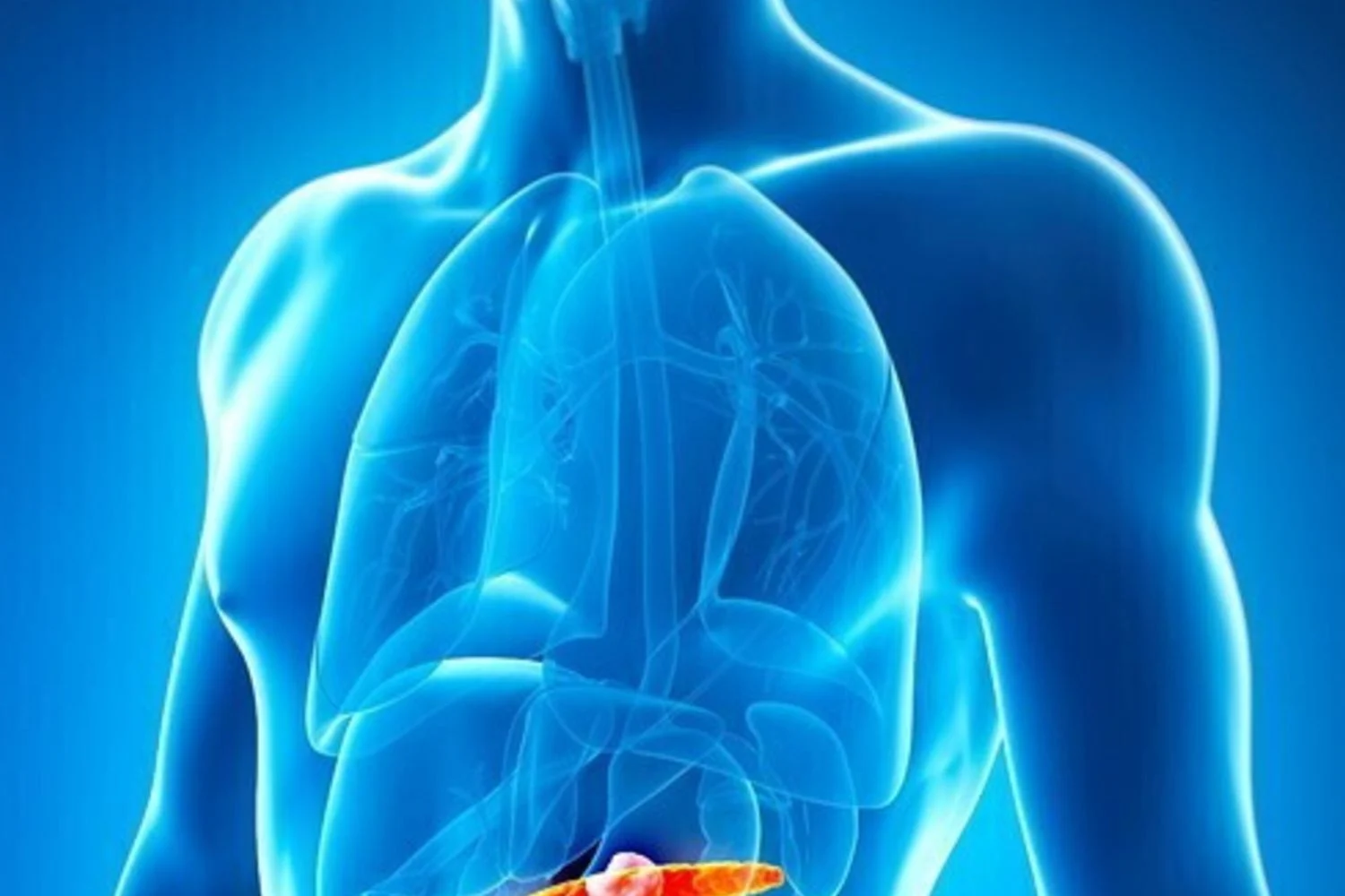 Tumor de pâncreas: evasão imunológica começa precocemente em nichos celulares