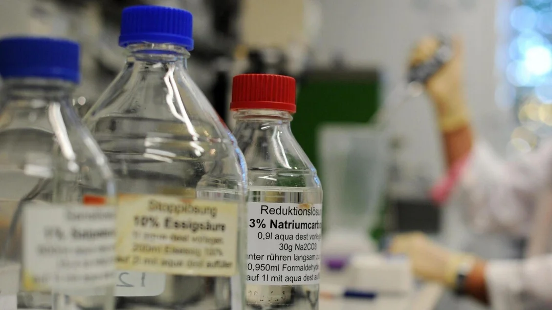 Universidade de Turim desvenda mecanismo molecular por trás da síndrome Nedamss