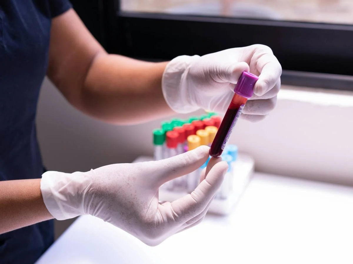 Estudo revela os valores de 3 biomarcadores que preveem risco de AVC em mulheres