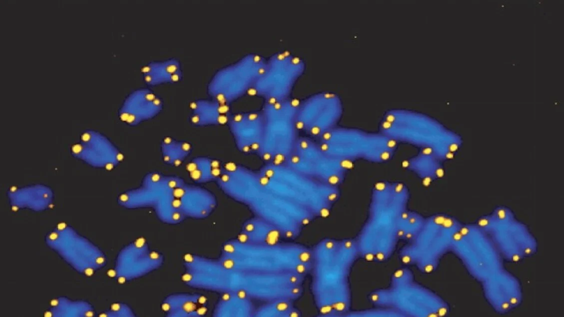 Telômeros danificados: estudo italiano aponta envelhecimento do DNA como causa do Alzheimer