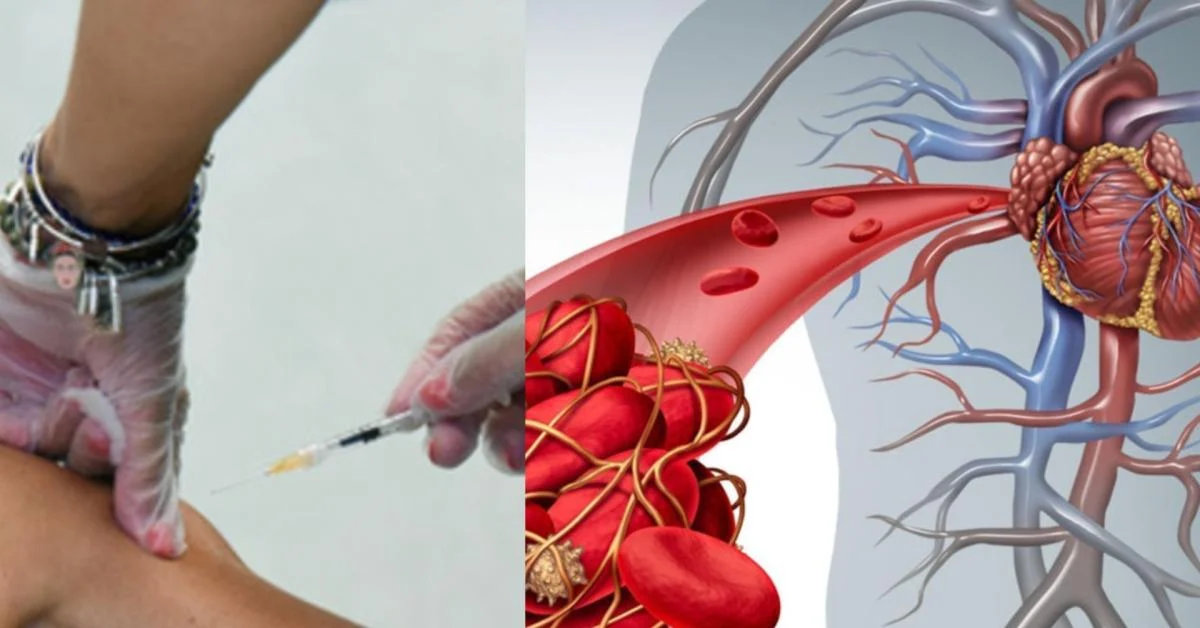 Comissão Militar reconhece ligação entre vacina Comirnaty e trombose que deixou soldado cego; mutação MTHFR pode explicar risco