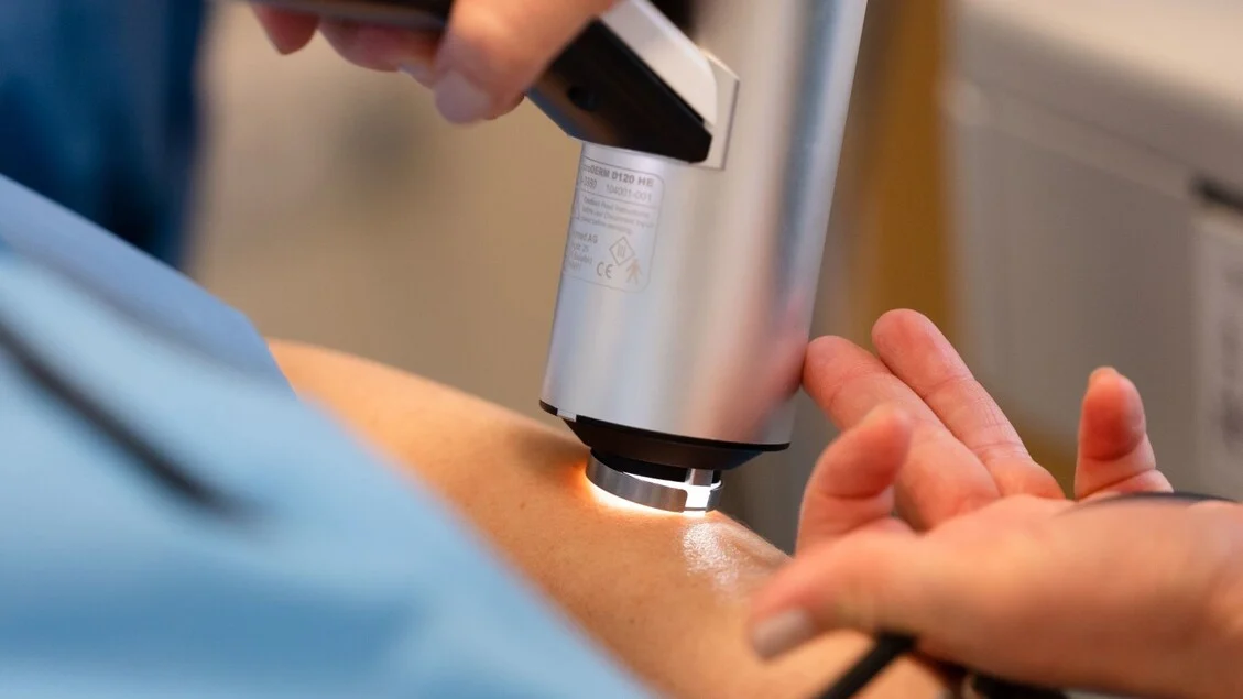 Melhora a prognose do melanoma cutâneo: mais pacientes curados em fase inicial