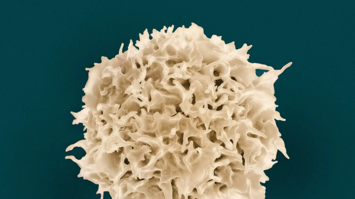 ISS identifica mecanismo pelo qual vírus de Epstein-Barr pode desencadear a esclerose múltipla