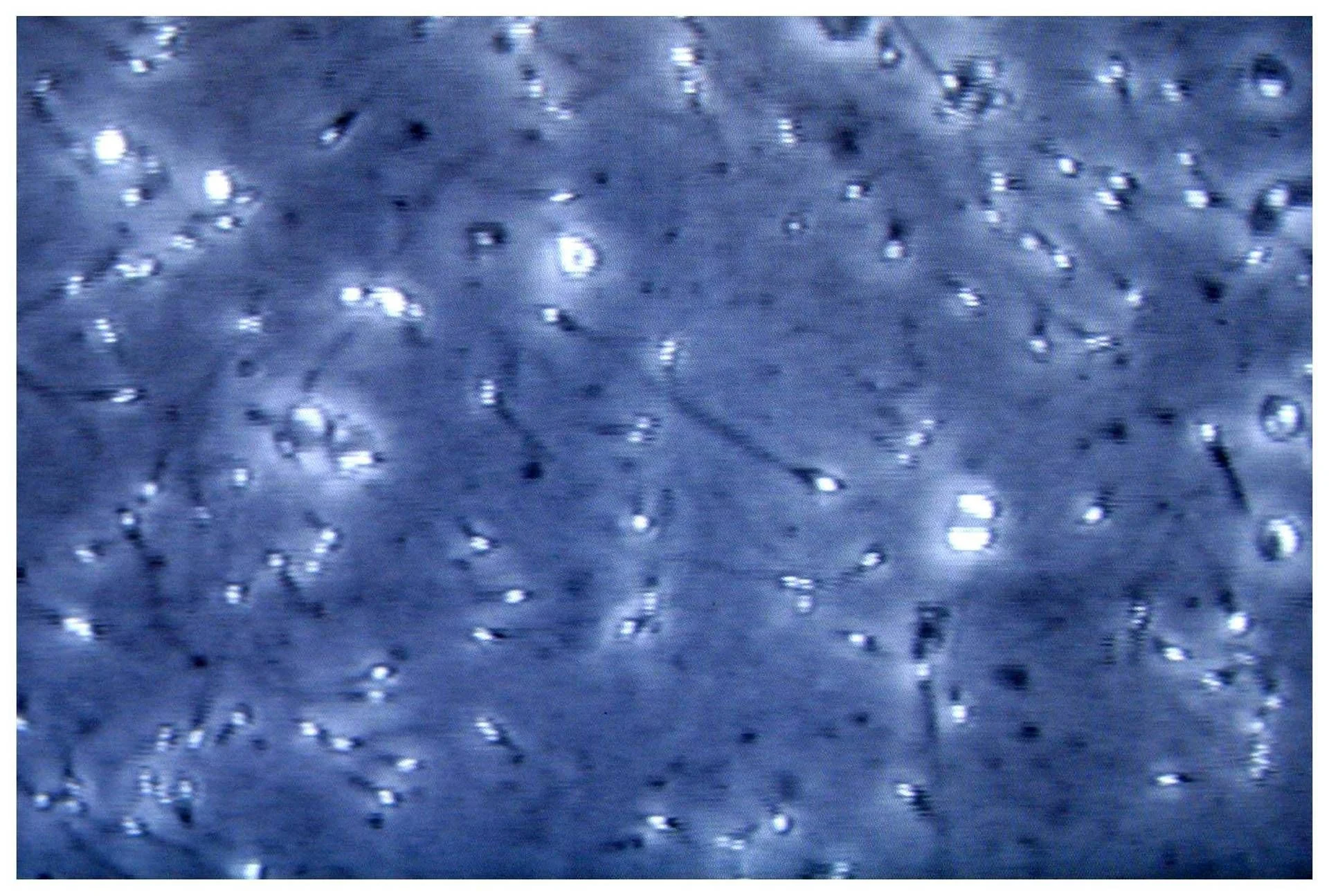 Microplásticos na próstata e no líquido seminal: estudo italiano revela alcance da contaminação